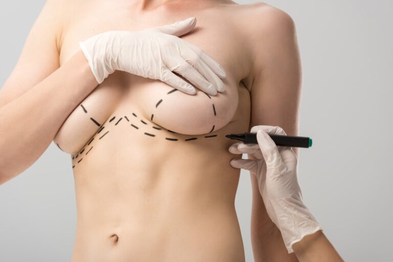 cropped view of plastic surgeon in latex gloves making marks on breast isolated on grey
